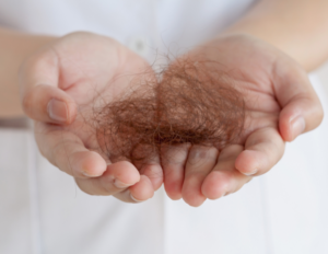 hair loss